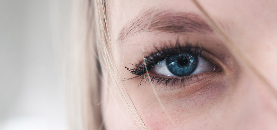 Frau mit blauem Auge